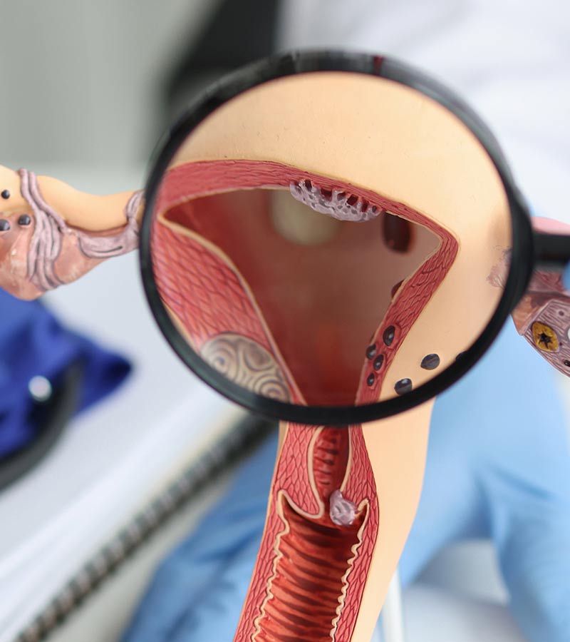 vaginal